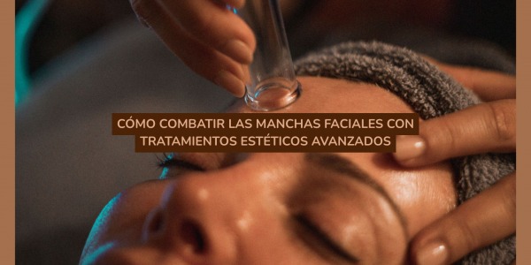 Cómo combatir las manchas faciales con tratamientos estéticos avanzados